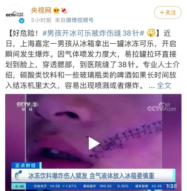 38针！只因夏天在冰箱放了这些东西！九游会J9冰箱突然爆炸！6岁男孩脸缝(图2)